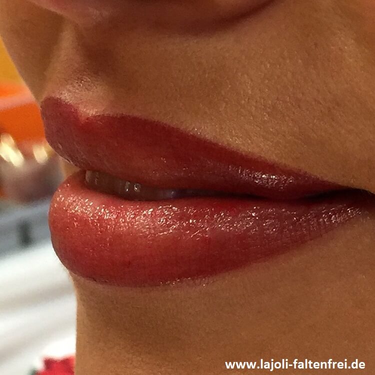 Lippen aufspritzen mit Hyaluronsäure und Permanent Make Up in der ästhetischen Praxis LAJOLI